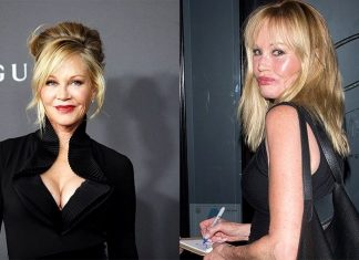 Celebrity face change mysteries… (Report)