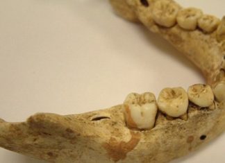 Research to find biological sex from a single tooth Research to find biological sex from a single tooth