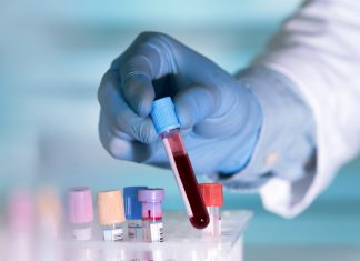 Blood Test Might Show Early Warning of Alzheimer’s disease Blood Test Might Show Early Warning of Alzheimer's disease