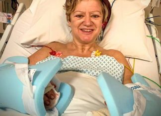 Corinne Hutton undergoes double hand transplant Corinne Hutton undergoes double hand transplant