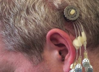 Researchers pioneer device to deliver drugs into brain Researchers pioneer device to deliver drugs into brain