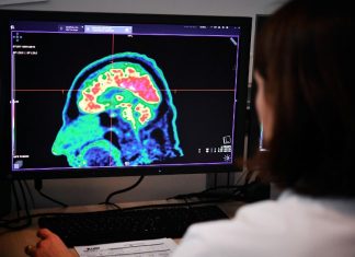 Women’s brains appear three years younger than men’s, a study has found Women's brains appear three years younger than men's, a study has found