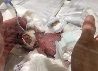 World smallest baby ever sent home leaves Tokyo hospital World smallest baby ever sent home leaves Tokyo hospital