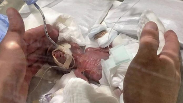 World smallest baby ever sent home leaves Tokyo hospital