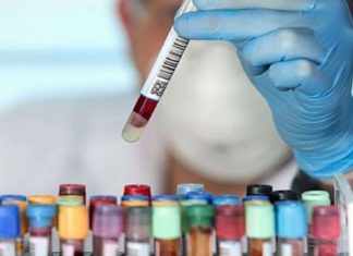 A second patient appears to be cured of HIV, Scientists Say A second patient appears to be cured of HIV, Scientists Say