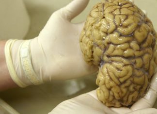 Researchers Partly Restore Activity in Dead-Pig Brains Researchers Partly Restore Activity in Dead-Pig Brains