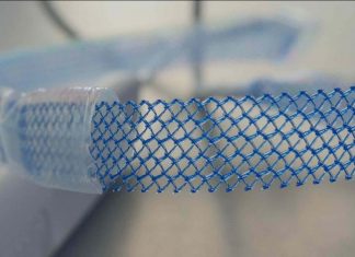 Vaginal mesh ban can be lifted with changes, Report Vaginal mesh ban can be lifted with changes, Report