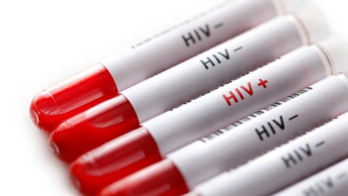 Aids breakthrough as study finds that drugs stop HIV transmission, Report