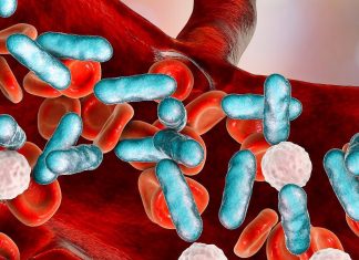 Sepsis bigger killer than cancer worldwide, According to Study Sepsis bigger killer than cancer worldwide, According to Study