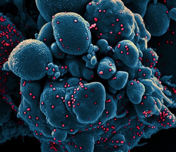 Coronavirus UK Updates: 'Likely' that new Sars-Cov-2 variant is already in Northern Ireland, Foster warns Coronavirus UK Updates: 'Likely' that new Sars-Cov-2 variant is already in Northern Ireland, Foster warns