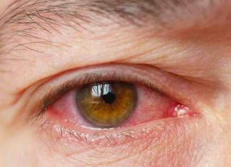 Coronavirus: Eye issues could be early Covid infection warning sign – symptoms to look out for Coronavirus: Eye issues could be early Covid infection warning sign - symptoms to look out for