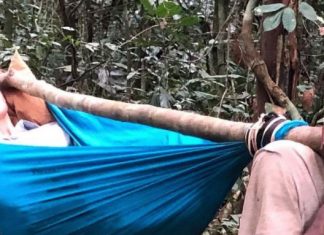 Ashley Judd shares images from leg accident in Congo (Picture) Ashley Judd shares images from leg accident in Congo (Picture)