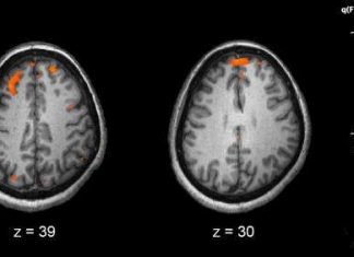 Research finds evidence of Bartonella infection in schizophrenia patients Research finds evidence of Bartonella infection in schizophrenia patients