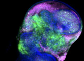 Dietary amino acid determines the fate of cancer cells, says study Dietary amino acid determines the fate of cancer cells, says study