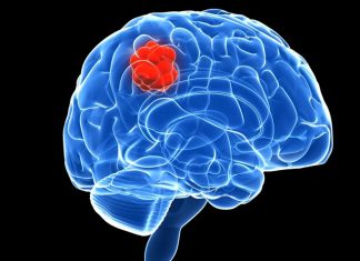 Scientists discover new way to starve brain tumours Scientists discover new way to starve brain tumours