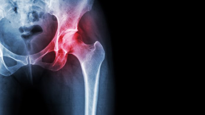 Scientists find method to regrow cartilage in the joints