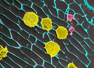 Study: Gel loaded with cancer-fighting cells keeps tumors in check after surgery in mice Study: Gel loaded with cancer-fighting cells keeps tumors in check after surgery in mice