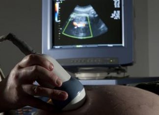 Study: Underweight and overweight women at higher risk of successive miscarriages Study: Underweight and overweight women at higher risk of successive miscarriages