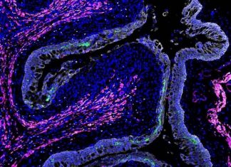 Study: Worm infestation in intestine has a remote effect on viral defenses Study: Worm infestation in intestine has a remote effect on viral defenses