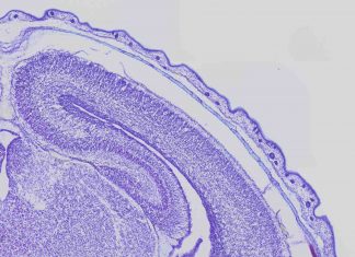 Defective gene slows down brain cells, says study Defective gene slows down brain cells, says study