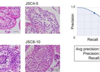 Male infertility scoring using AI-assisted image classification requiring no programming (Study) Male infertility scoring using AI-assisted image classification requiring no programming (Study)
