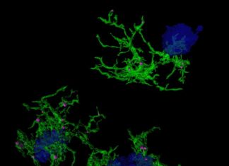 Recherchers discover gene signature for plaque-eating microglia in Alzheimer’s Disease Recherchers discover gene signature for plaque-eating microglia in Alzheimer's Disease