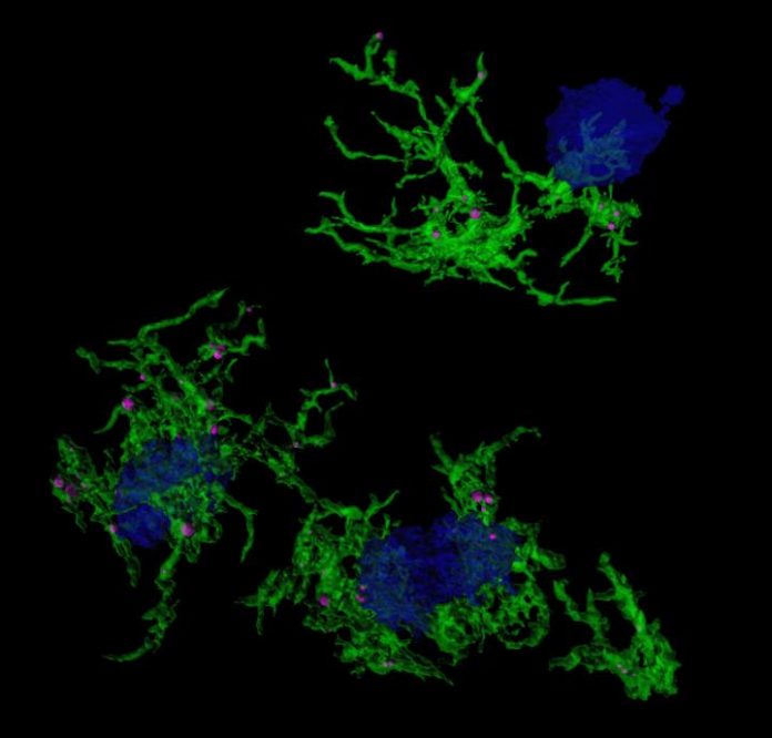 Recherchers discover gene signature for plaque-eating microglia in Alzheimer's Disease