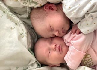 Research of twins shows it’s genetics that controls abnormal development Research of twins shows it’s genetics that controls abnormal development