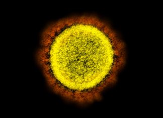 Study: Coloured compounds may help coronavirus evade antibodies Study: Coloured compounds may help coronavirus evade antibodies