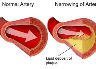 Study: Could a vaccine protect us against heart attacks? Study: Could a vaccine protect us against heart attacks?