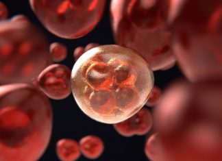 Study: Intestinal polyps in close relatives can increase risk of colorectal cancer Study: Intestinal polyps in close relatives can increase risk of colorectal cancer