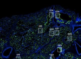 Study: Large collaboration creates cell atlas of COVID-19 pathology Study: Large collaboration creates cell atlas of COVID-19 pathology