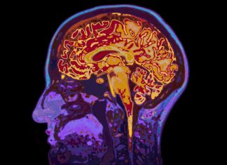 Study: New clues into why people with type 2 diabetes develop dementia Study: New clues into why people with type 2 diabetes develop dementia