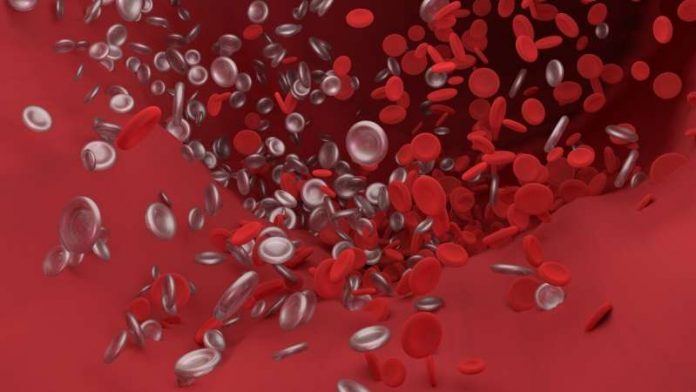 Study: Predicting blood clots before they happen in pediatric patients