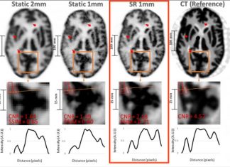 Research: New super-resolution technique allows for more detailed brain imaging Research: New super-resolution technique allows for more detailed brain imaging