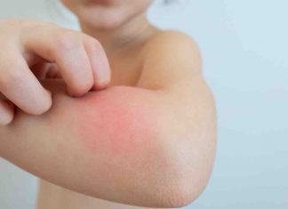 Study: Defective epithelial barriers linked to two billion chronic diseases Study: Defective epithelial barriers linked to two billion chronic diseases