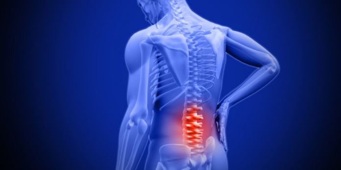 Study: Inflatable, shape-changing spinal implants could help treat severe pain