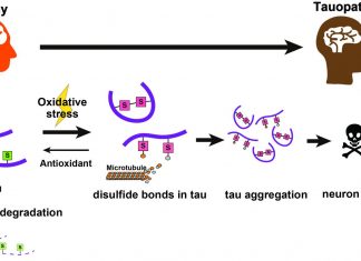 Toxicity of protein involved in Alzheimer’s triggered by a chemical ‘switch’, says study Toxicity of protein involved in Alzheimer's triggered by a chemical 'switch', says study