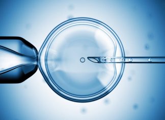 Study: Patients paying for unproven IVF add-on treatments Study: Patients paying for unproven IVF add-on treatments