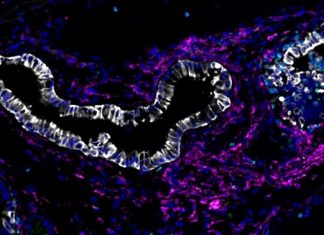 Study: Why identical mutations cause different types of cancer Study: Why identical mutations cause different types of cancer