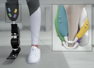 Study: Magnets could offer better control of prosthetic limbs Study: Magnets could offer better control of prosthetic limbs