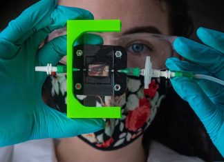 Study: Rice team creating insulin-producing implant for Type 1 diabetes Study: Rice team creating insulin-producing implant for Type 1 diabetes