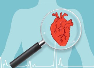 More than 40 percent of adults with no known heart disease had fatty deposits in heart arteries More than 40 percent of adults with no known heart disease had fatty deposits in heart arteries