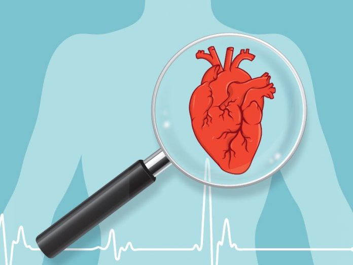 More than 40 percent of adults with no known heart disease had fatty deposits in heart arteries