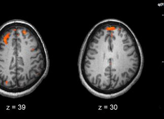 New research results support eliminating the term “schizophrenic” from clinical practice New research results support eliminating the term “schizophrenic” from clinical practice