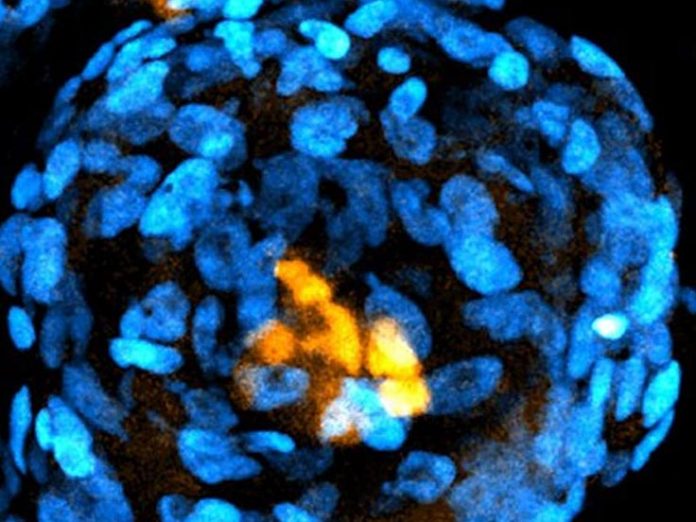 Researchers Build Embryo-Like Structures From Human Stem Cells