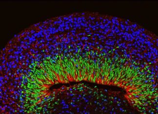 Researchers develop brain organoids with complex neural activity Researchers develop brain organoids with complex neural activity