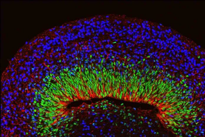 Researchers develop brain organoids with complex neural activity
