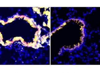 Researchers find a new way to reverse immune suppression in tumors Researchers find a new way to reverse immune suppression in tumors