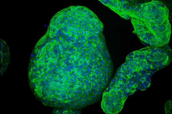 Researchers grow pancreatic “organoids” that mimic the real thing